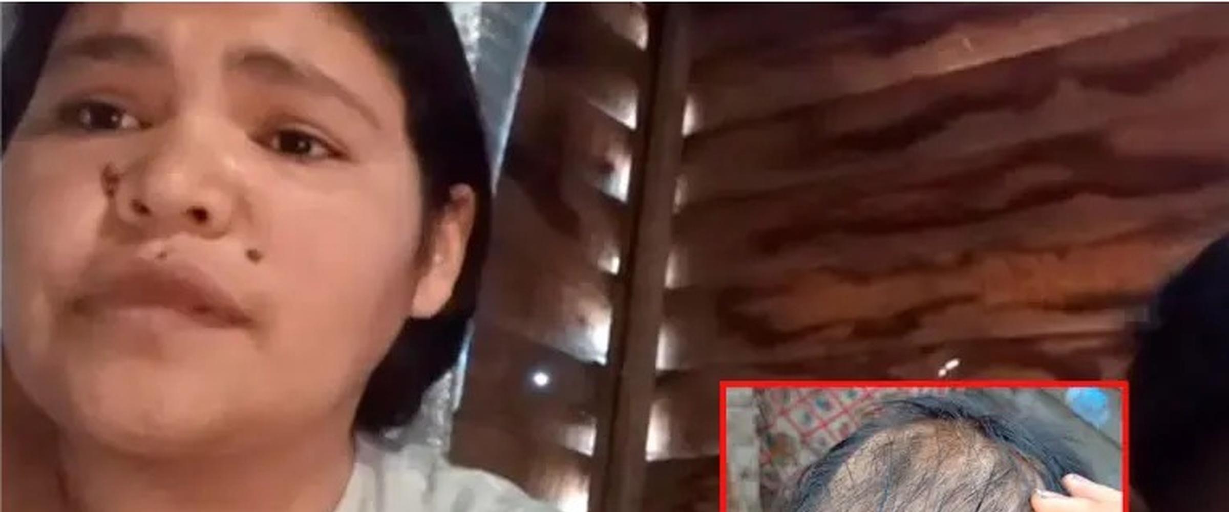 “Por él hago lo imposible”: una mamá de Concordia pide ayuda para el tratamiento de su hijo